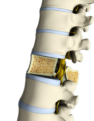 Osteopathy